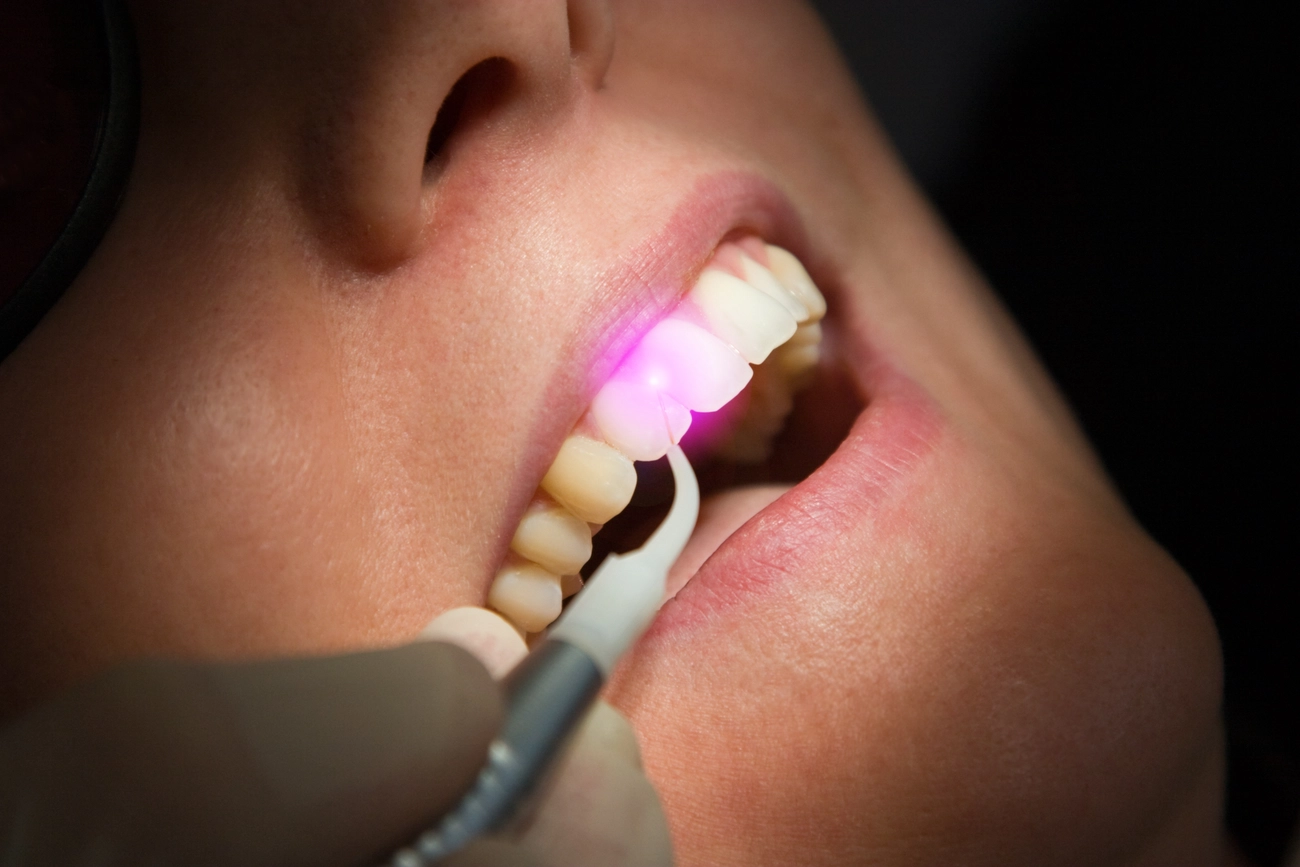 EQ Smile - Zahnarztpraxis - Dental Laser Zahnbehandlung
